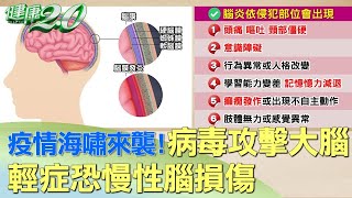 疫情海嘯來襲！病毒攻擊大腦 輕症恐慢性腦損傷 健康2.0