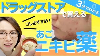 【医師が推薦】顎ニキビで悩む人におすすめな市販薬を3分で解説！