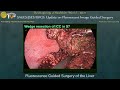 Fluorescence Guided Surgery of the Liver