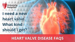 I need a new heart valve. What kind should I get?