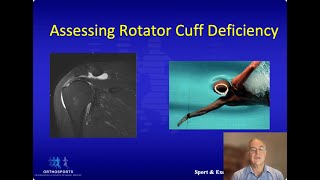 2022 12 Assessing rotator cuff deficiency – Dr John Best