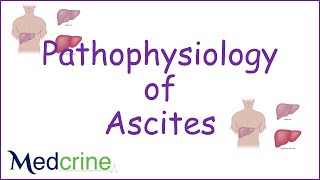 pathophysiology of ascites