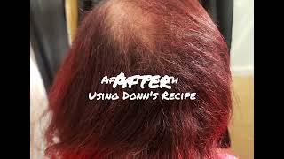 Donna's Recipe Biotin Do it really work