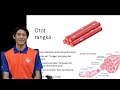 SISTEM OTOT | SAINS SUKAN STPM