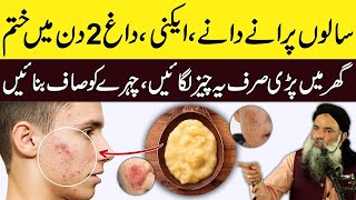 Face Ke Daag Kaise Hataye | Face Ke Pimple Kaise Hataye | Acne Treatment at Home Dr Sharafat Ali New