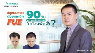 ปลูกผมถาวรด้วยเทคนิค FUE 90 วันไม่ต้องพักฟื้น