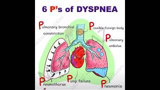 Causes of Dyspnea - Mneumonic