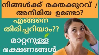 Anemia|രക്തക്കുറവ് മാറ്റാൻ |how to increase hemoglobin