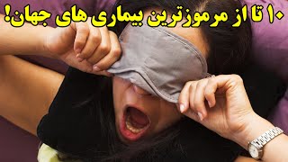 ۱۰ تا از مرموزترین بیماری های جهان!