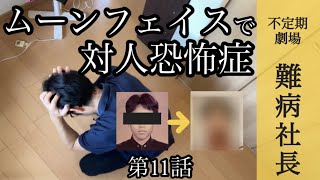 難病にステロイド治療を行った結果、副作用が辛く対人恐怖症になりました