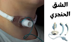 حلقة اتصالات اهالي المرضي (الشق الحنجري)