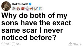 Why do both of my sons have the exact same scar I never noticed before?