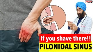 Pilonidal Sinus & Cyst क्या है कैसे ठीक होगा | Dr.Education