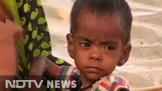 Malnourishment rampant in Madhya Pradesh village, kids battle for life