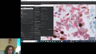 Detecting (Positive) Cells with QuPath