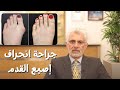 جراحة انحراف إصبع القدم -  Minimally Invasive Bunion Surgery