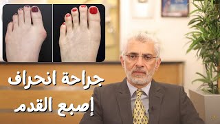 جراحة انحراف إصبع القدم -  Minimally Invasive Bunion Surgery