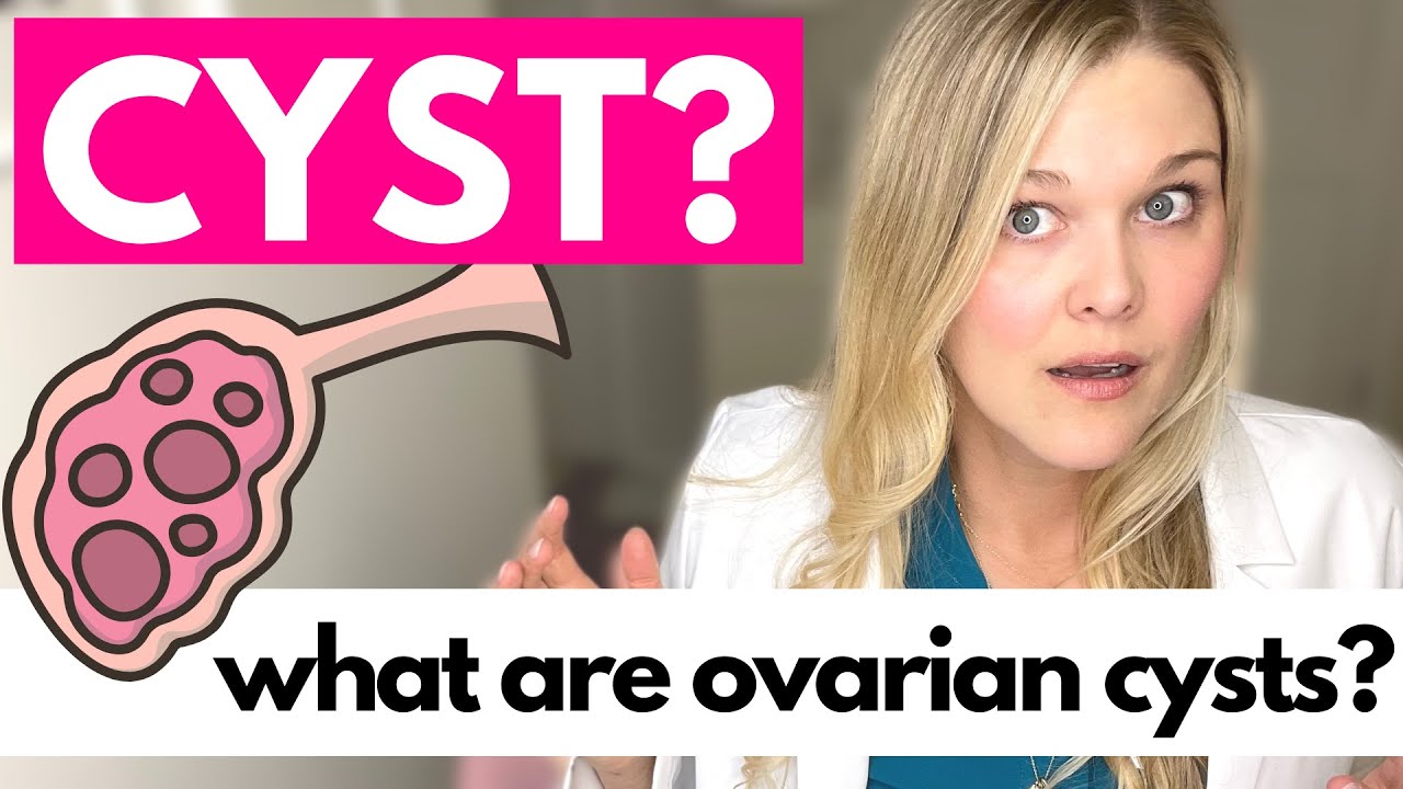 Ovarian Cysts What Causes Ovarian Cysts Youtube Ovarian Cysts What Causes Ovarian Cysts Youtube