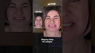 Dental Motion Design For Beginners 🤘 Ads for dentists