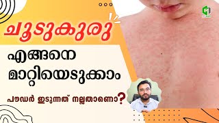 ചൂടുകുരു ഉള്ളവർ ഇത് ശ്രദ്ധിക്കുക/How to Prevent prickly Heat.#health #prickly_heat#drammar