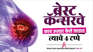 Treatment Of Breast Cancer | ब्रेस्ट कॅन्सरच्या उपचाराचे ४ टप्पे | Breast Cancer Treatment - 4 Step