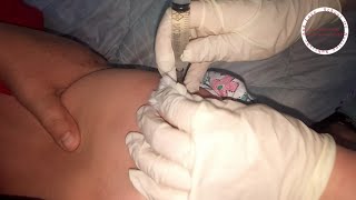 A shot in the buttock. intramuscular injection buttock , butt injection to child
