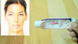 best skin lightening cream - Elosone-ht cream - by Unbeatable Products