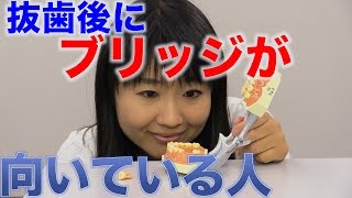 抜歯のあとにブリッジが向いている人　口腔ケアチャンネル　566（口腔ケアチャンネル2　＃239）