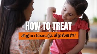 வெட்டுக்கள் மற்றும் காயத்தை எப்படி குணப்படுத்துவது | How to treat minor cuts and scrapes | FSO