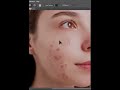 How to remove pimples easily in photoshop 2022 || Only for beginners