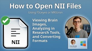How to Open NII Files (FSLeyes or MRIcron)