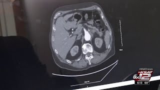 Abdominal Aneurysms: Silent Killers