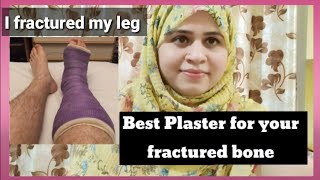 which plaster is best for your fractured bone.True Review of fiberglass cast plaster.Fiberglass cast