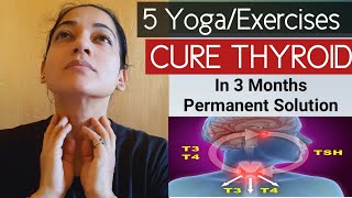 5 Yoga/Exercises To Cure Thyroid Problem Permanently | Cure Thyroid In 3 Months ( 100% Guaranteed)