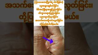 အသက်လမ်းအစက ကြာဖူး