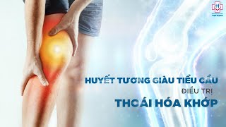 ĐIỀU TRỊ THOÁI HÓA KHỚP GỐI BẰNG TIÊM HUYẾT TƯƠNG GIÀU TIỂU CẦU