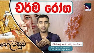 චර්ම රෝග හැදෙන්නේ ඇයි ? | Skin diseases