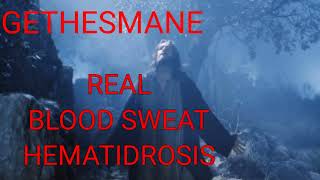 இயேசு கிறிஸ்துவின் இரத்த வியர்வை பற்றியது இது உண்மை/HEMATIDROSIS BLOOD SWEAT GETHESMANE