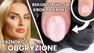 Jak przedłużyć obgryzione paznokcie żelem? Rekonstrukcja paznokcia obgryzionego | Indigo Nails