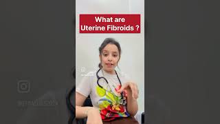 Rasoli | Uterine Fibroids Doctor | Cancer gynae#youtubeshorts #shorts #short #rasoli #gynae #uterus