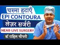 Near Live! Epi Contoura Streamlight Eye Surgery | No Flap, No Blade, No Touch, No Cut Eye Laser