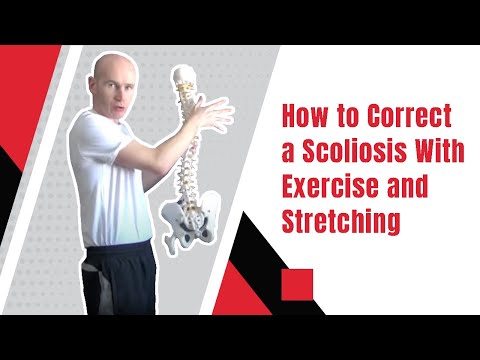 How to Correct a Scoliosis With Exercise and Stretching | Edward Paget How to Correct a Scoliosis With Exercise and Stretching | Edward Paget
