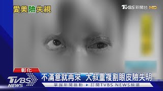 嚮往朱一龍「卡姿蘭大眼睛」  重複割眼皮險失明｜TVBS新聞