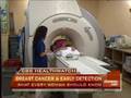 Breast Cancer And MRIs