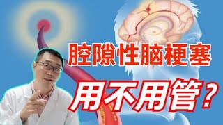 腔隙性脑梗塞，要不要治疗？医生却说：做完脑CT发现腔梗注意2点