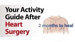 Your Activity Guide After Heart Surgery