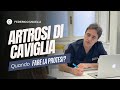 Artrosi di caviglia: se e quando pensare ad una protesi!