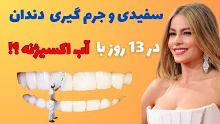 بهترین خمیر دندان سفید کننده در دنیا/ راز دندان های سفید و قدرتمند