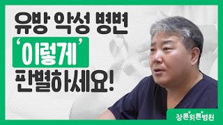 유방 악성 병변 '이렇게' 알 수 있다.