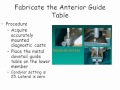 Fabricate an anterior guide table